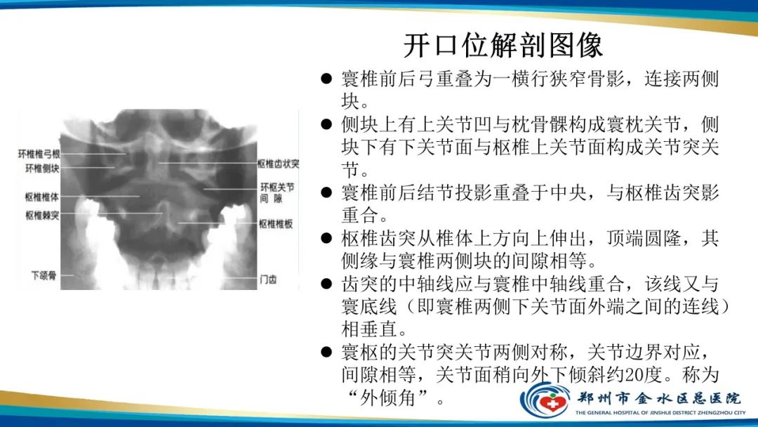 影像PPT - 【PPT】颈椎拍片技术与临床意义-14