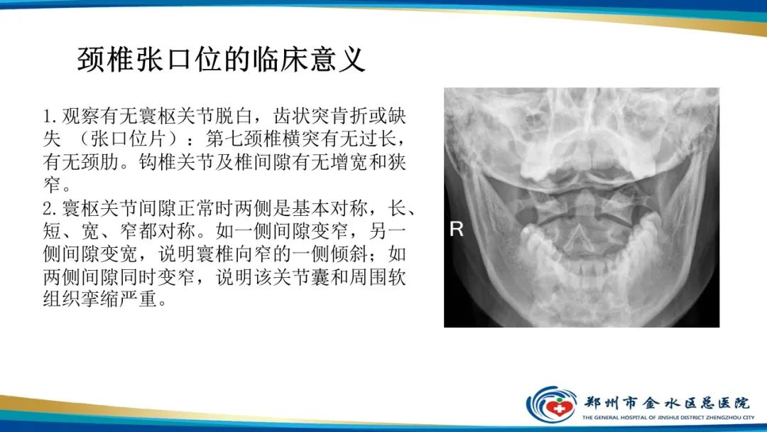 影像PPT - 【PPT】颈椎拍片技术与临床意义-15