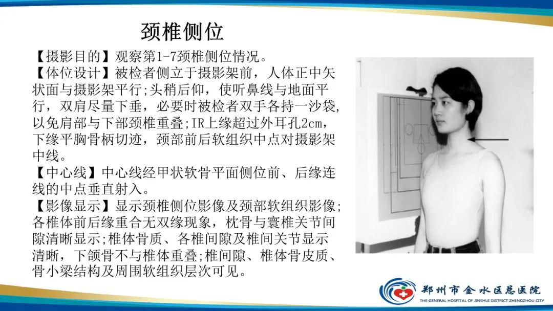 影像PPT - 【PPT】颈椎拍片技术与临床意义-16