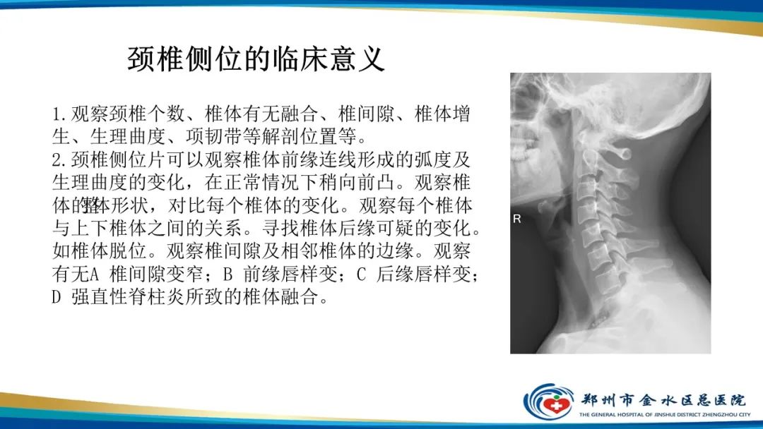 影像PPT - 【PPT】颈椎拍片技术与临床意义-18
