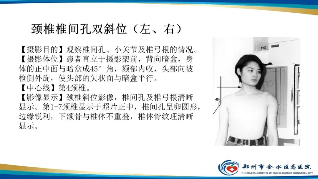 影像PPT - 【PPT】颈椎拍片技术与临床意义-19