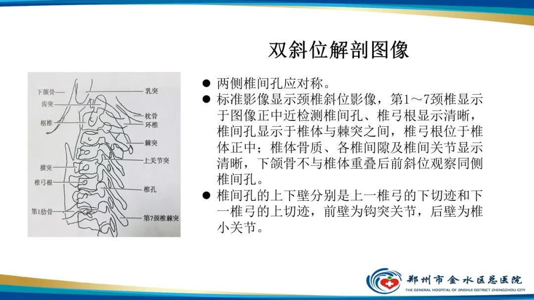影像PPT - 【PPT】颈椎拍片技术与临床意义-20