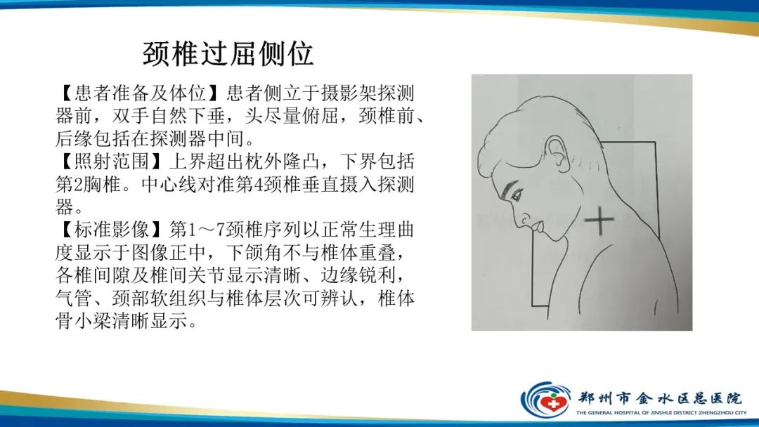 影像PPT - 【PPT】颈椎拍片技术与临床意义-23