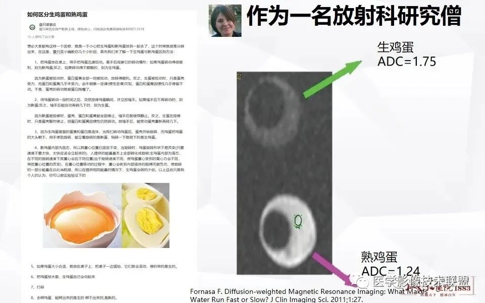 影像PPT - 【PPT】磁共振弥散成像的原理及应用-5