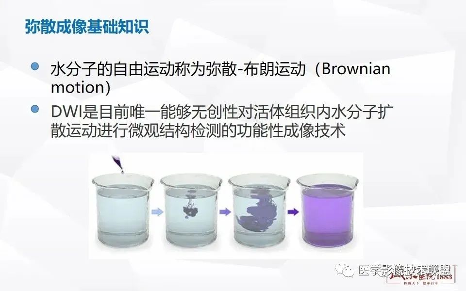 影像PPT - 【PPT】磁共振弥散成像的原理及应用-6