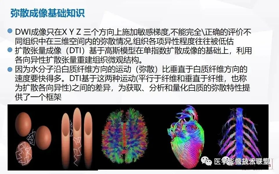 影像PPT - 【PPT】磁共振弥散成像的原理及应用-8
