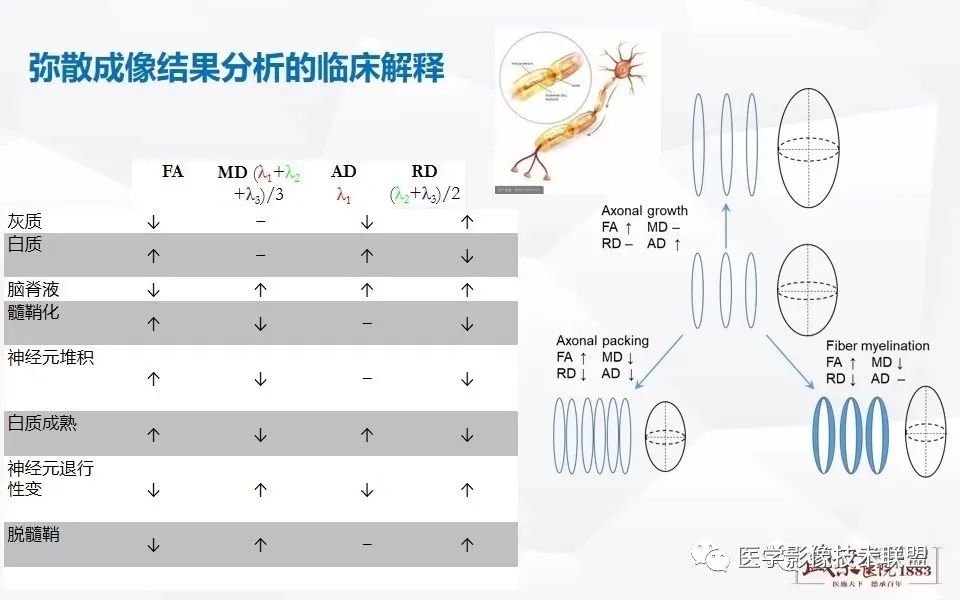 影像PPT - 【PPT】磁共振弥散成像的原理及应用-13