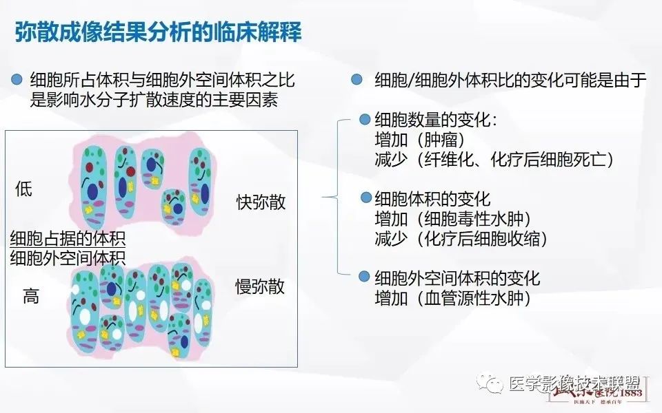 影像PPT - 【PPT】磁共振弥散成像的原理及应用-15