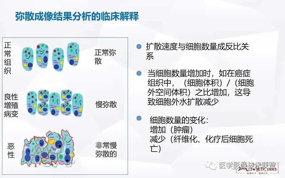 影像PPT - 【PPT】磁共振弥散成像的原理及应用-16