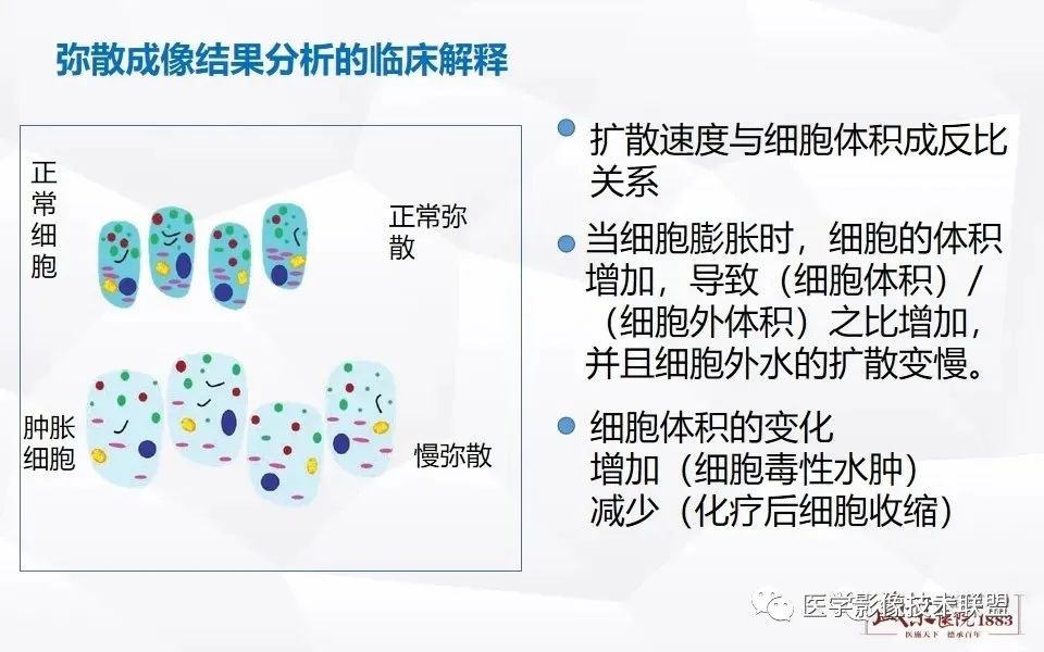 影像PPT - 【PPT】磁共振弥散成像的原理及应用-18