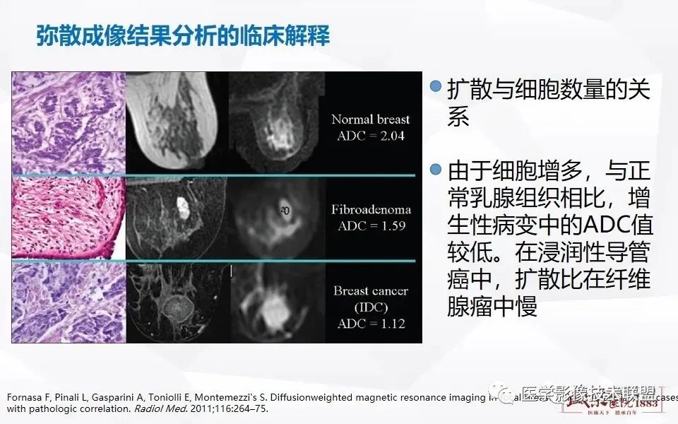 影像PPT - 【PPT】磁共振弥散成像的原理及应用-17