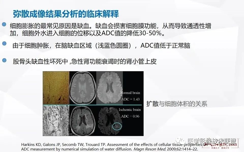 影像PPT - 【PPT】磁共振弥散成像的原理及应用-19