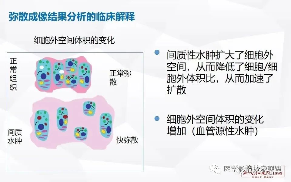 影像PPT - 【PPT】磁共振弥散成像的原理及应用-20