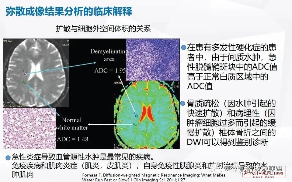 影像PPT - 【PPT】磁共振弥散成像的原理及应用-21