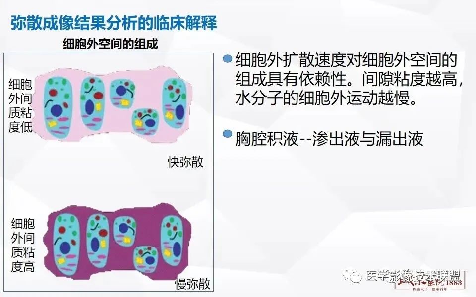 影像PPT - 【PPT】磁共振弥散成像的原理及应用-22
