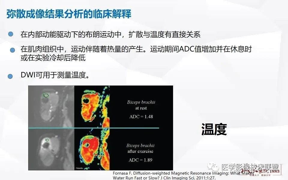 影像PPT - 【PPT】磁共振弥散成像的原理及应用-24