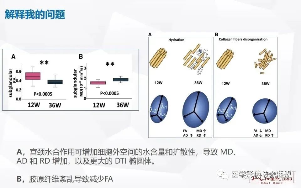 影像PPT - 【PPT】磁共振弥散成像的原理及应用-25