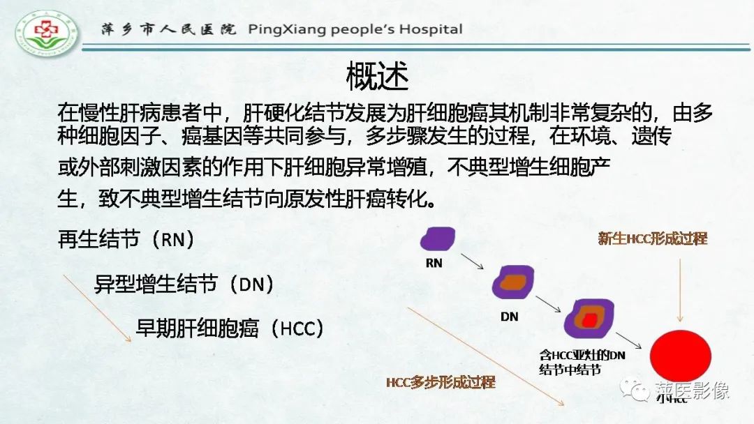 影像PPT - 【PPT】HCC影像诊断思路-17