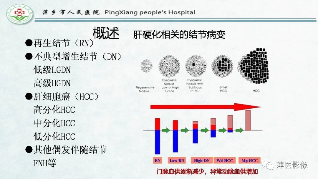 影像PPT - 【PPT】HCC影像诊断思路-18