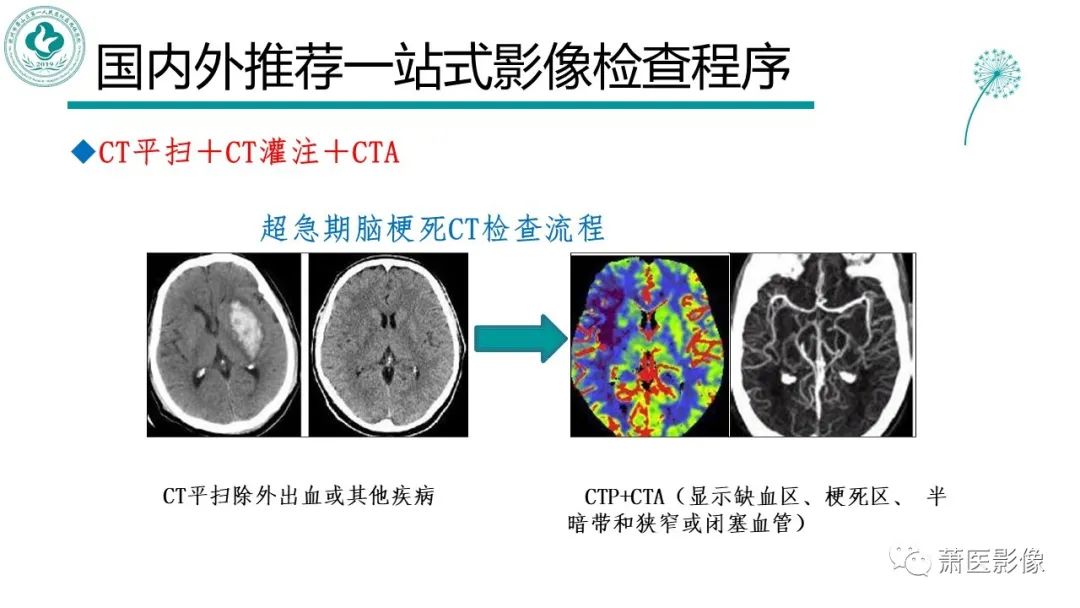 影像PPT - 【PPT】脑灌注成像原理及在临床中的应用-6