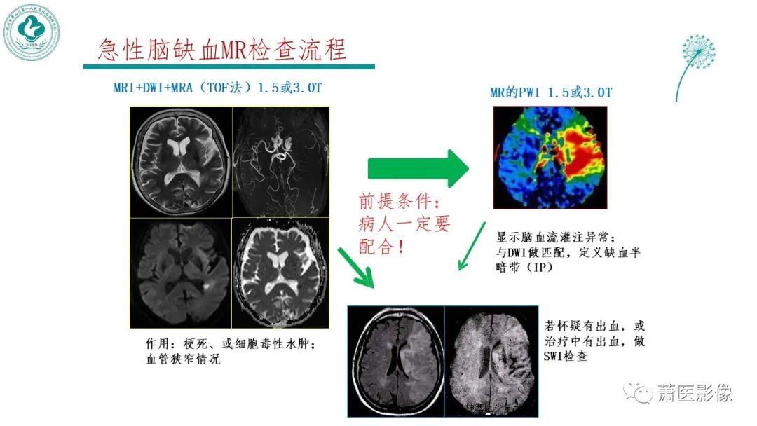 影像PPT - 【PPT】脑灌注成像原理及在临床中的应用-7