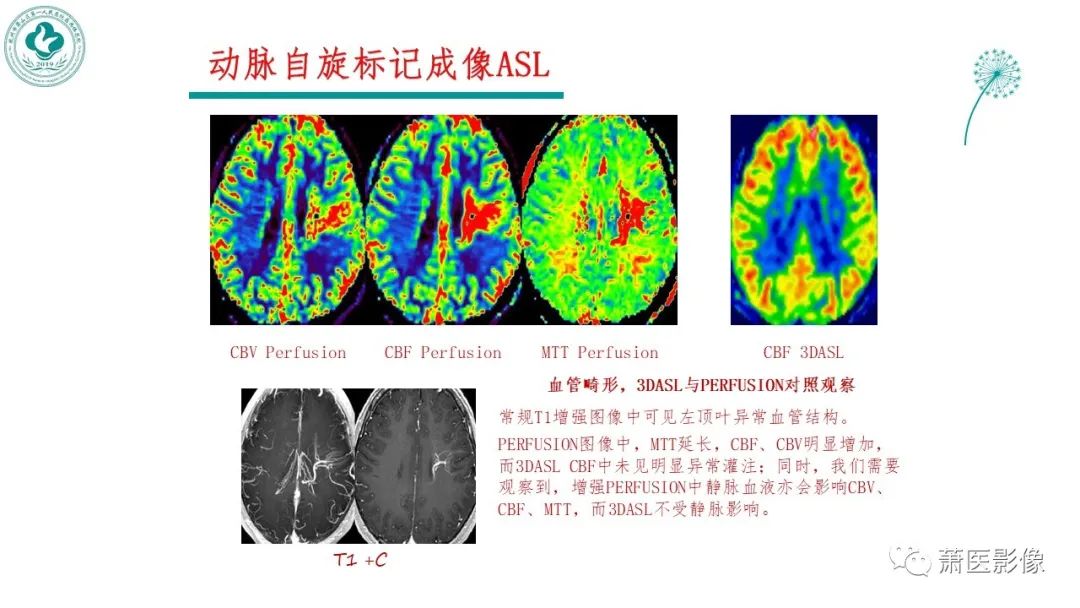 影像PPT - 【PPT】脑灌注成像原理及在临床中的应用-11