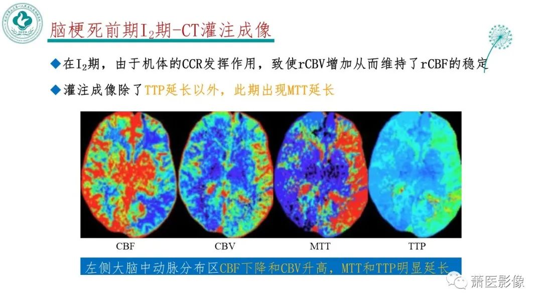 影像PPT - 【PPT】脑灌注成像原理及在临床中的应用-18