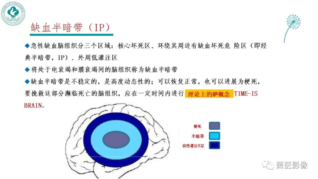 影像PPT - 【PPT】脑灌注成像原理及在临床中的应用-24