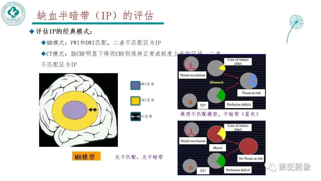 影像PPT - 【PPT】脑灌注成像原理及在临床中的应用-25