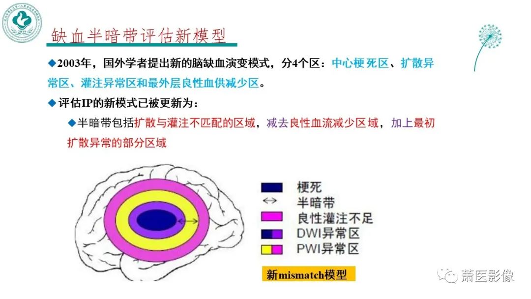影像PPT - 【PPT】脑灌注成像原理及在临床中的应用-30