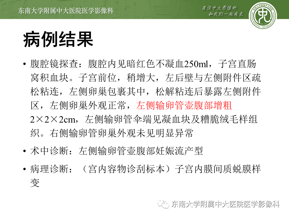 影像PPT - 【PPT】常见妇科急腹症的超声-放射诊断-4