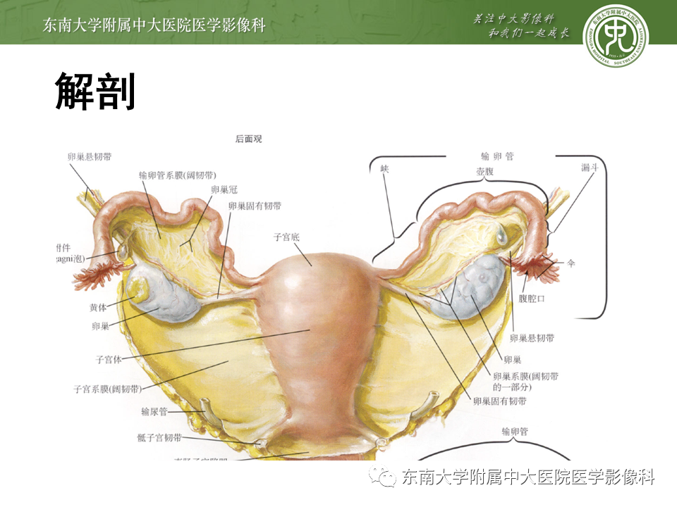 影像PPT - 【PPT】常见妇科急腹症的超声-放射诊断-8