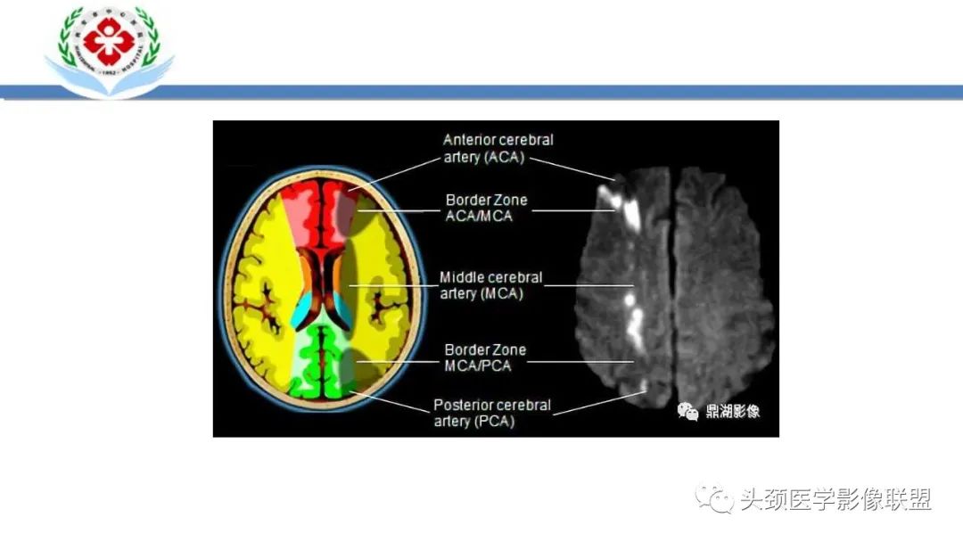 影像PPT - 【PPT】特鲁索综合征-24