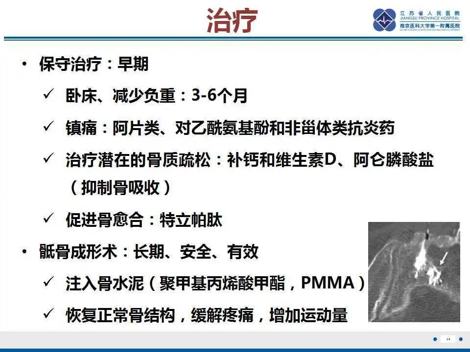 影像PPT - 【PPT】骶骨机能不全骨折-25