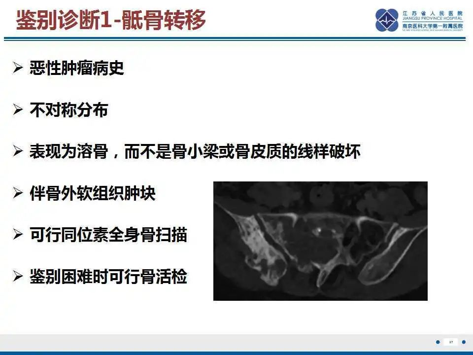 影像PPT - 【PPT】骶骨机能不全骨折-28