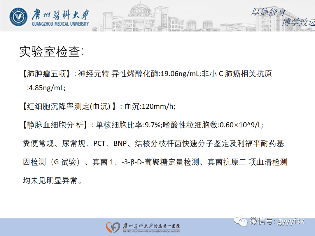 影像PPT - 【病例】隐源性机化性肺炎1例CT影像-3