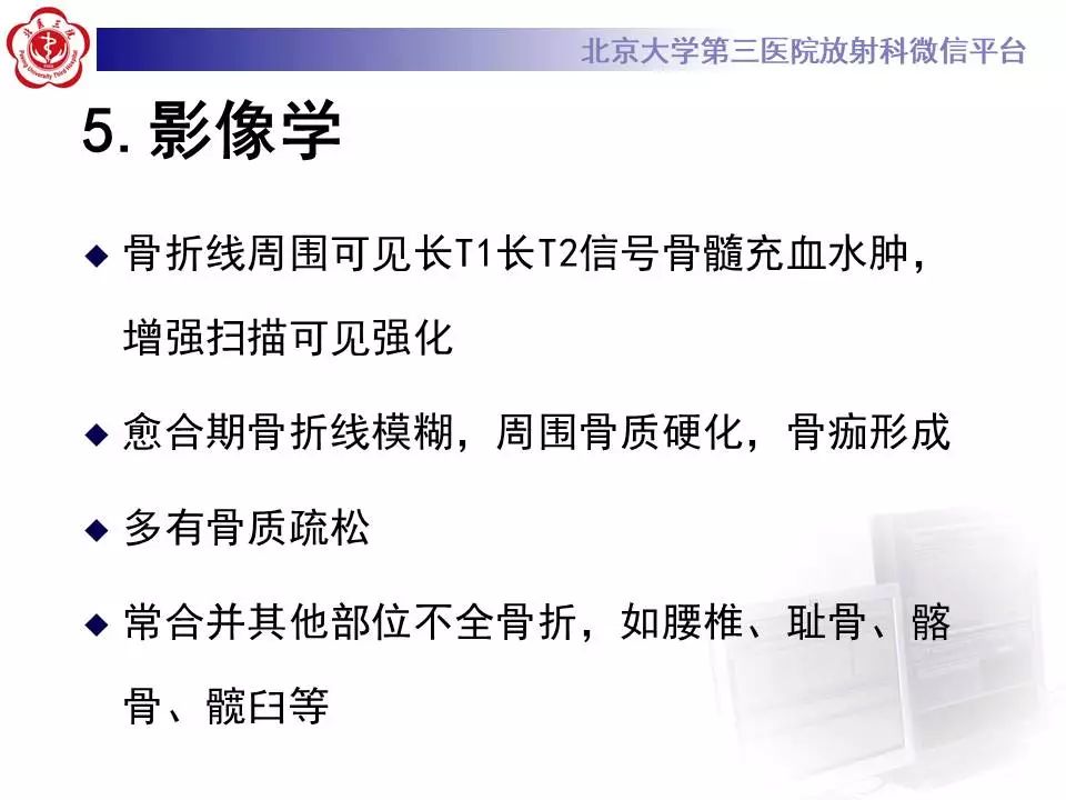影像PPT - 【PPT】骶骨不全骨折-18