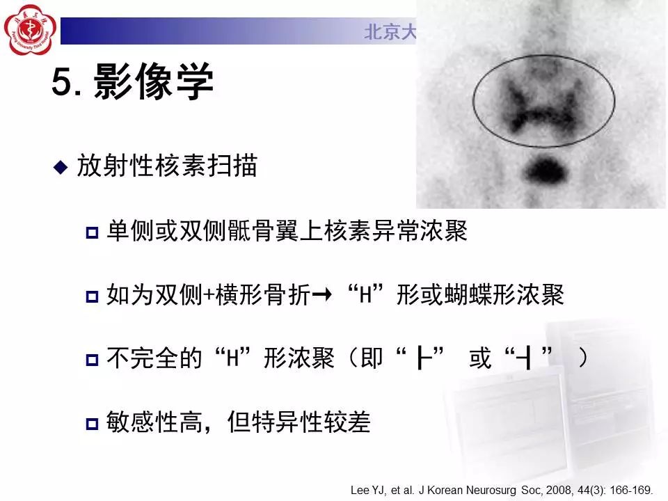 影像PPT - 【PPT】骶骨不全骨折-19