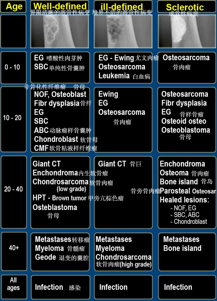 影像PPT - 骨肿瘤鉴别诊断的分析路径-2 影像PPT - 骨肿瘤鉴别诊断的分析路径-2