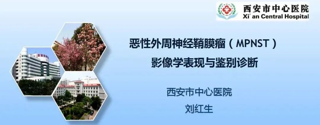 影像PPT - 【PPT】恶性外周神经鞘膜瘤(MPNST)影像学表现与鉴别诊断-1 影像PPT - 【PPT】恶性外周神经鞘膜瘤(MPNST)影像学表现与鉴别诊断-1