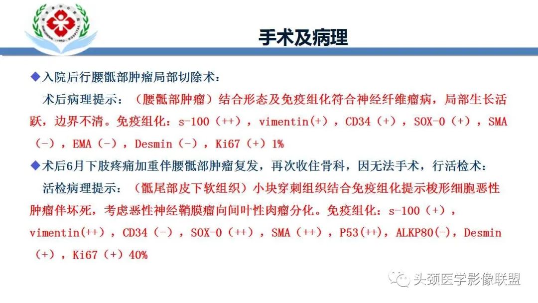 影像PPT - 【PPT】恶性外周神经鞘膜瘤(MPNST)影像学表现与鉴别诊断-42 影像PPT - 【PPT】恶性外周神经鞘膜瘤(MPNST)影像学表现与鉴别诊断-42
