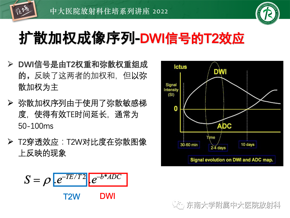 影像PPT - 【PPT】DWI序列解读-18