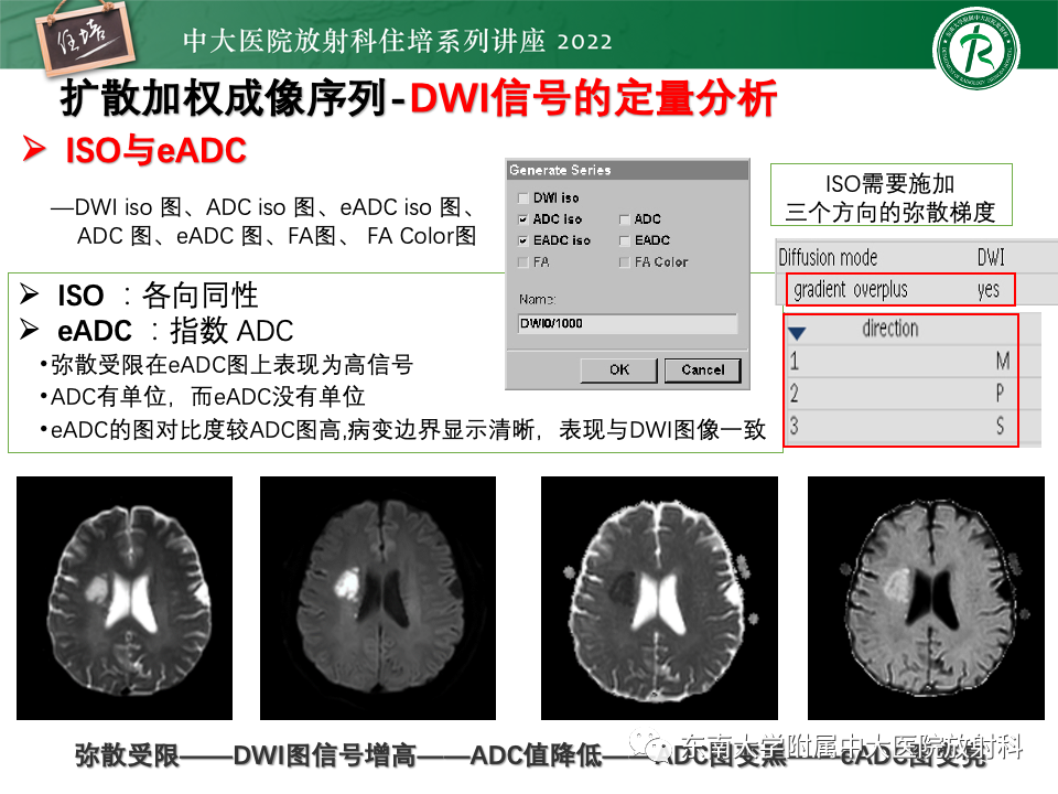 影像PPT - 【PPT】DWI序列解读-22