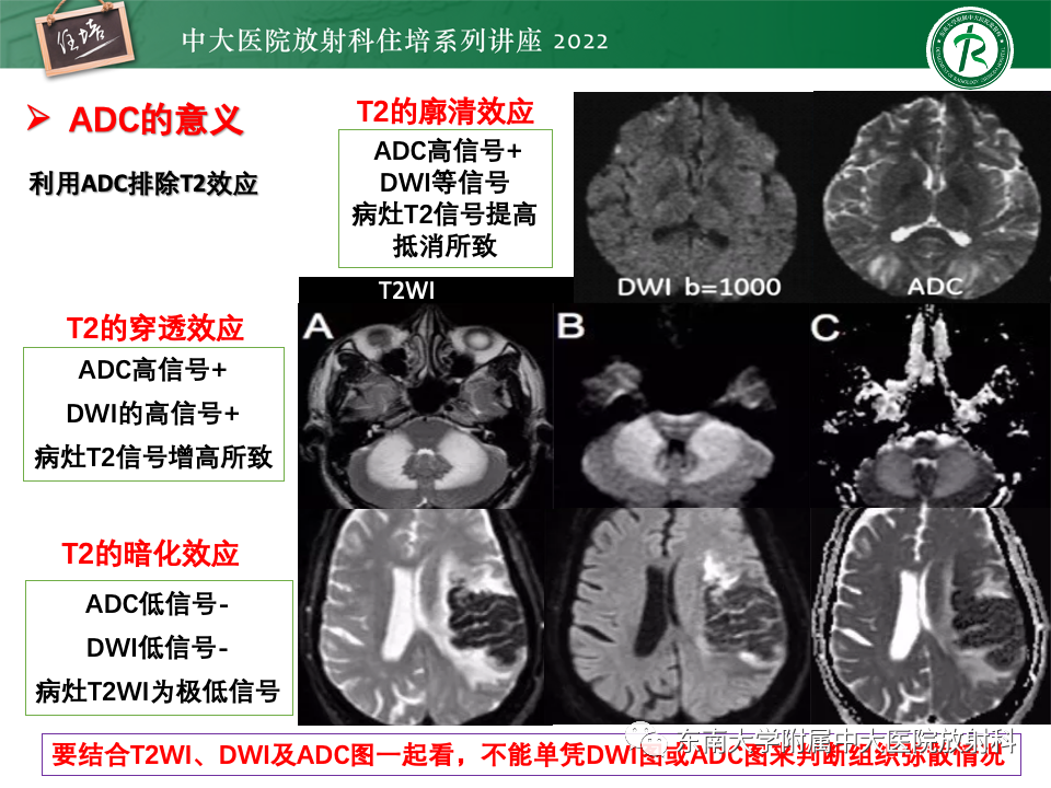 影像PPT - 【PPT】DWI序列解读-21