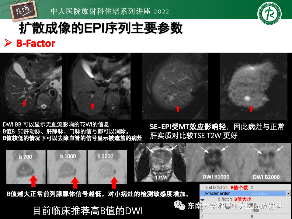 影像PPT - 【PPT】DWI序列解读-25
