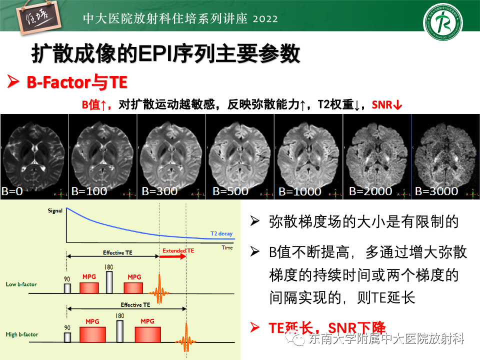 影像PPT - 【PPT】DWI序列解读-26