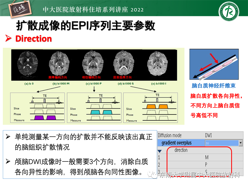 影像PPT - 【PPT】DWI序列解读-29