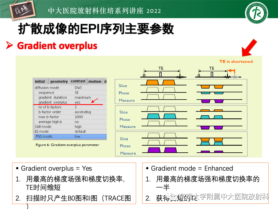 影像PPT - 【PPT】DWI序列解读-30