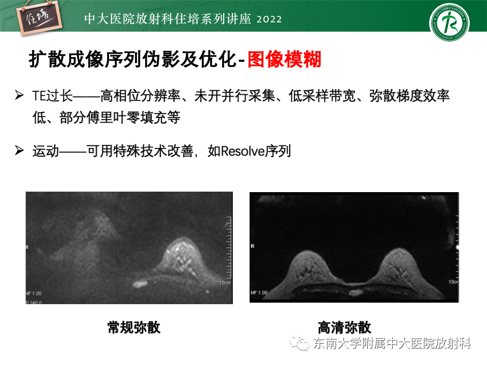 影像PPT - 【PPT】DWI序列解读-33