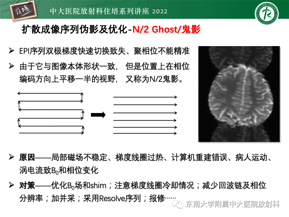 影像PPT - 【PPT】DWI序列解读-34